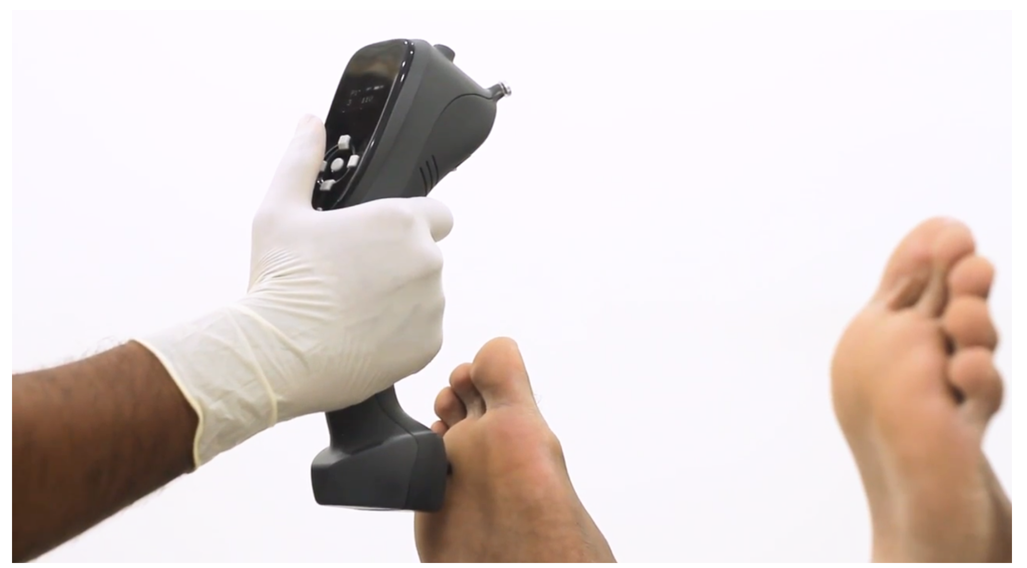 Neuro Touch - Peripheral Neuropathy Screening - Neurology Diagnostic Devices - Medical Equipment - Fu Kang Online Store Neuro Touch - Peripheral Neuropathy Screening - Neurology Diagnostic Devices - Medical Equipment - Fu Kang Online Store